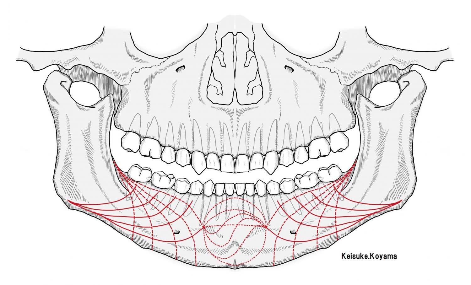 小山慶介イラスト　Keisuke Koyama Ideal miniplate position in mandibular　fainal-2