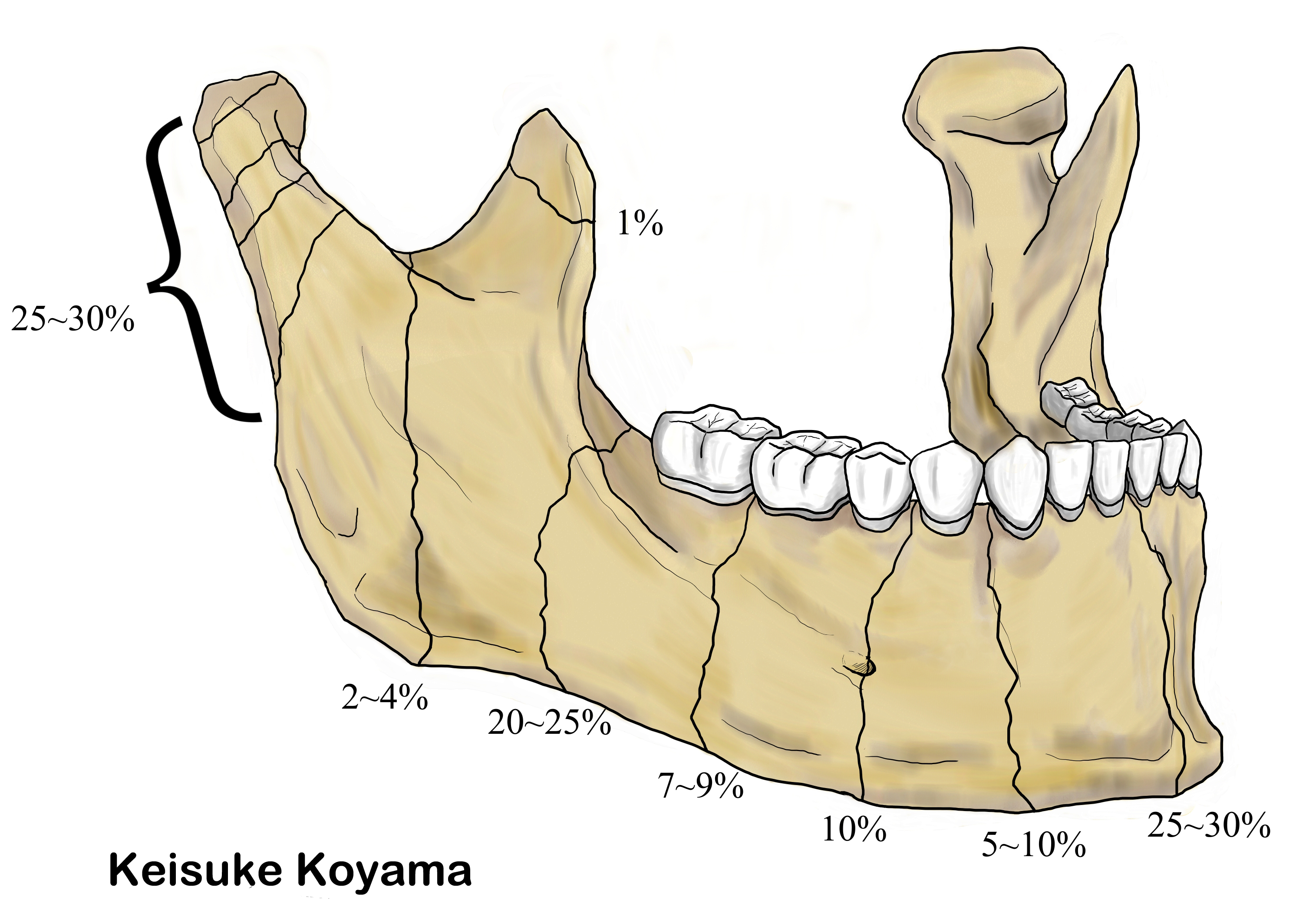 小山慶介イラスト　Keisuke Koyama fractures line 1-2