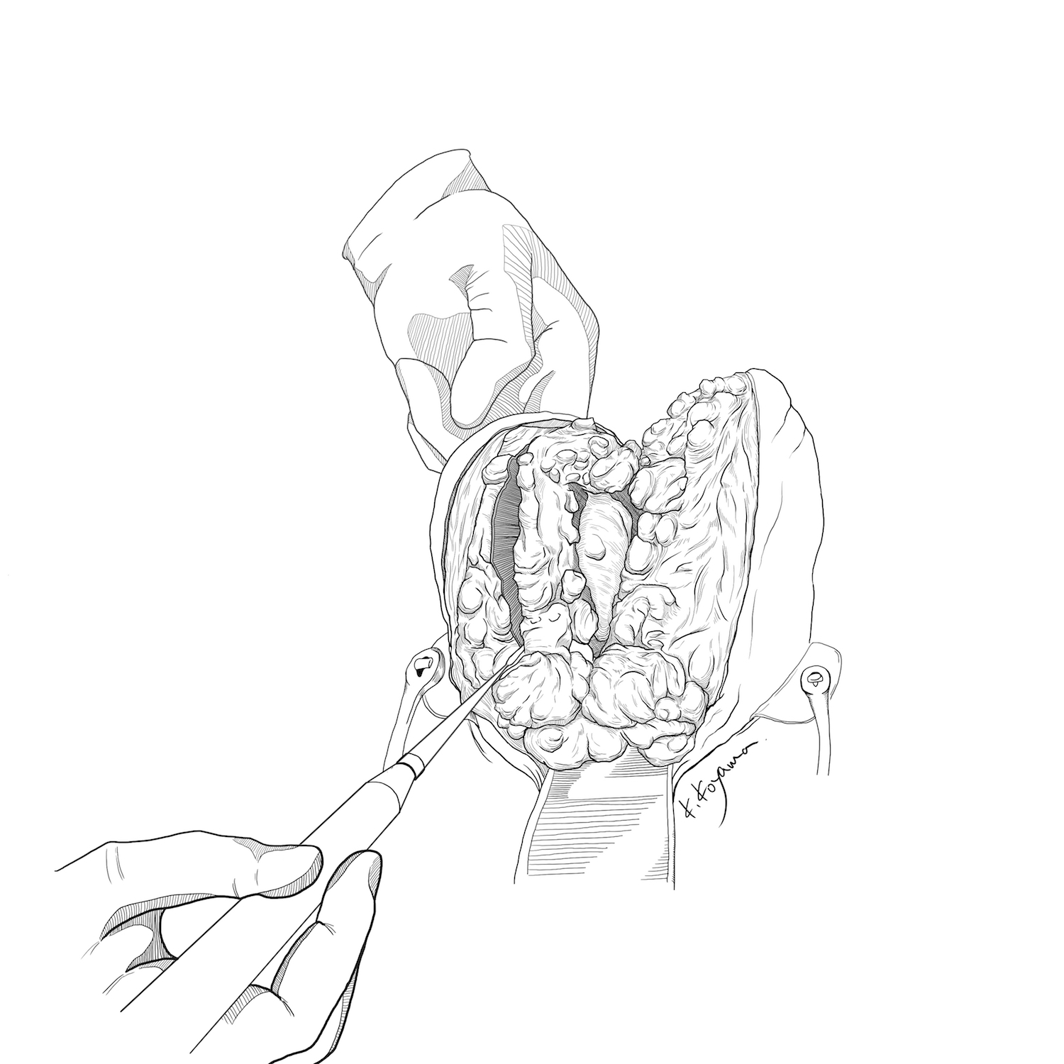 医療用イラストならではの利点 描き方 論文 著書 学会発表という目的に合わせる 絵を描く口腔外科医kaak Studio