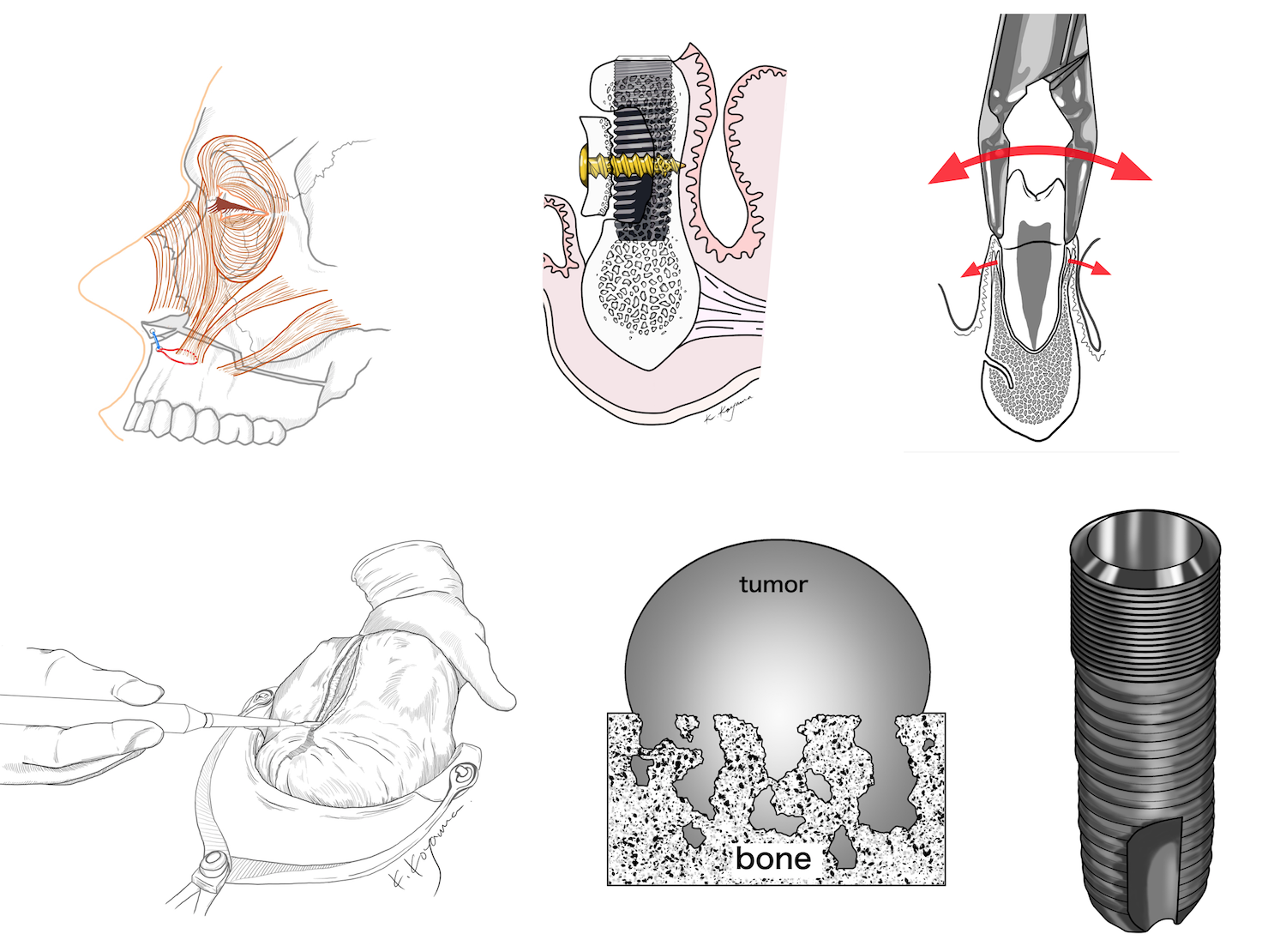 医療用イラストならではの利点 描き方 論文 著書 学会発表という目的に合わせる 絵を描く口腔外科医kaak Studio