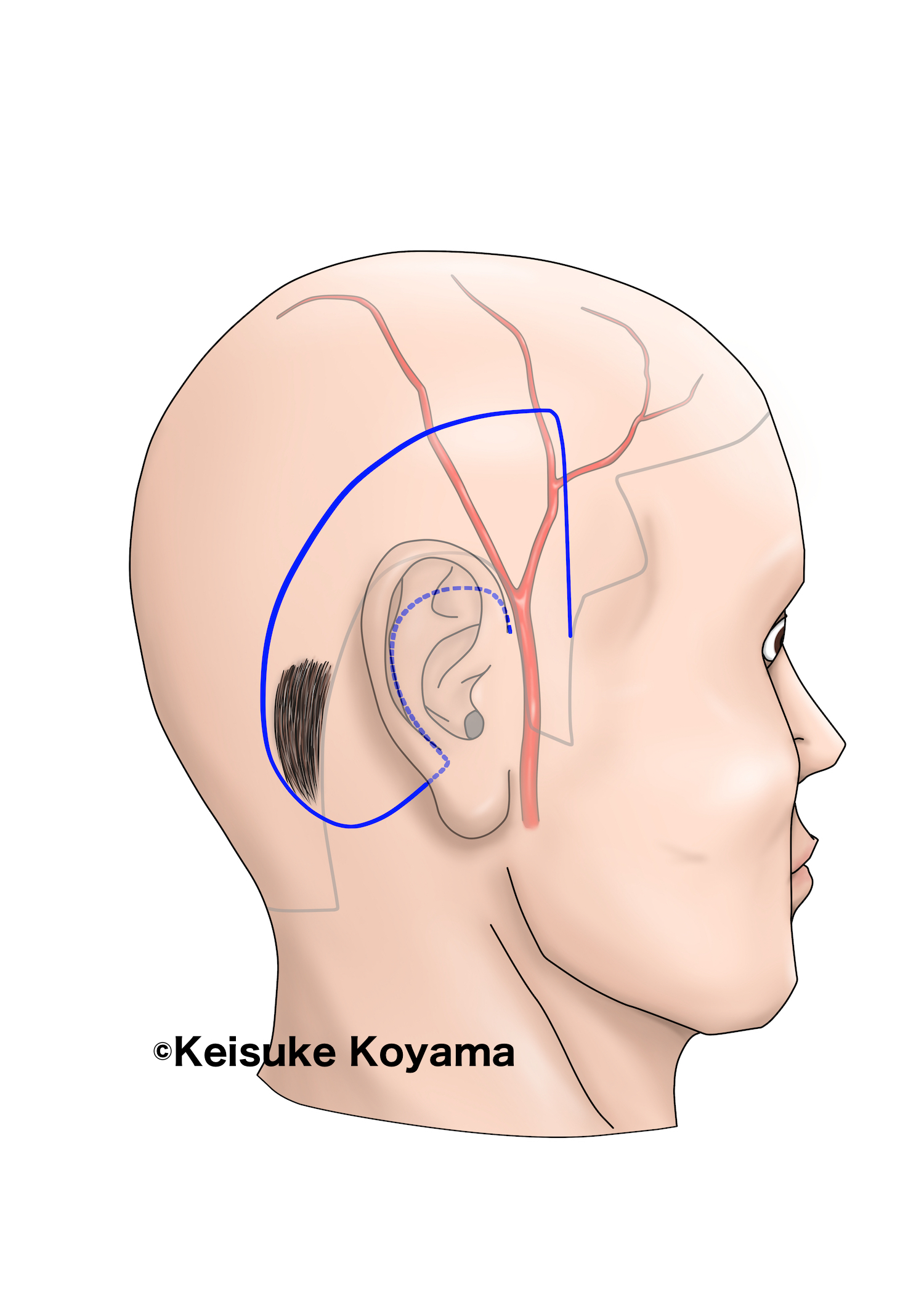 論文用シェーマ・小山慶介・Keisuke Koyama