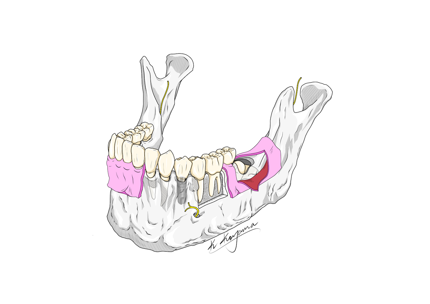 下顎骨イラスト・小山慶介