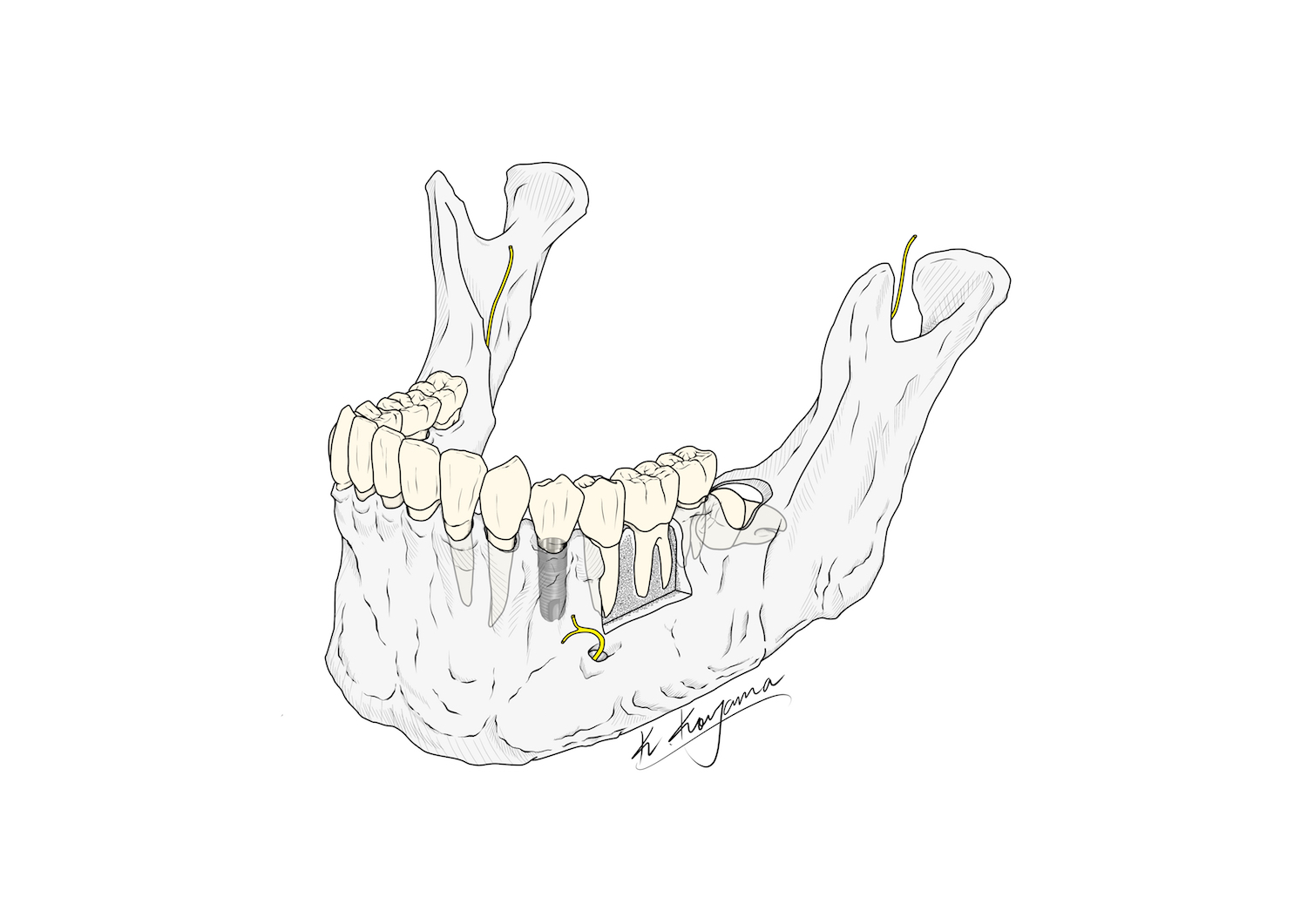 下顎骨イラスト・小山慶介