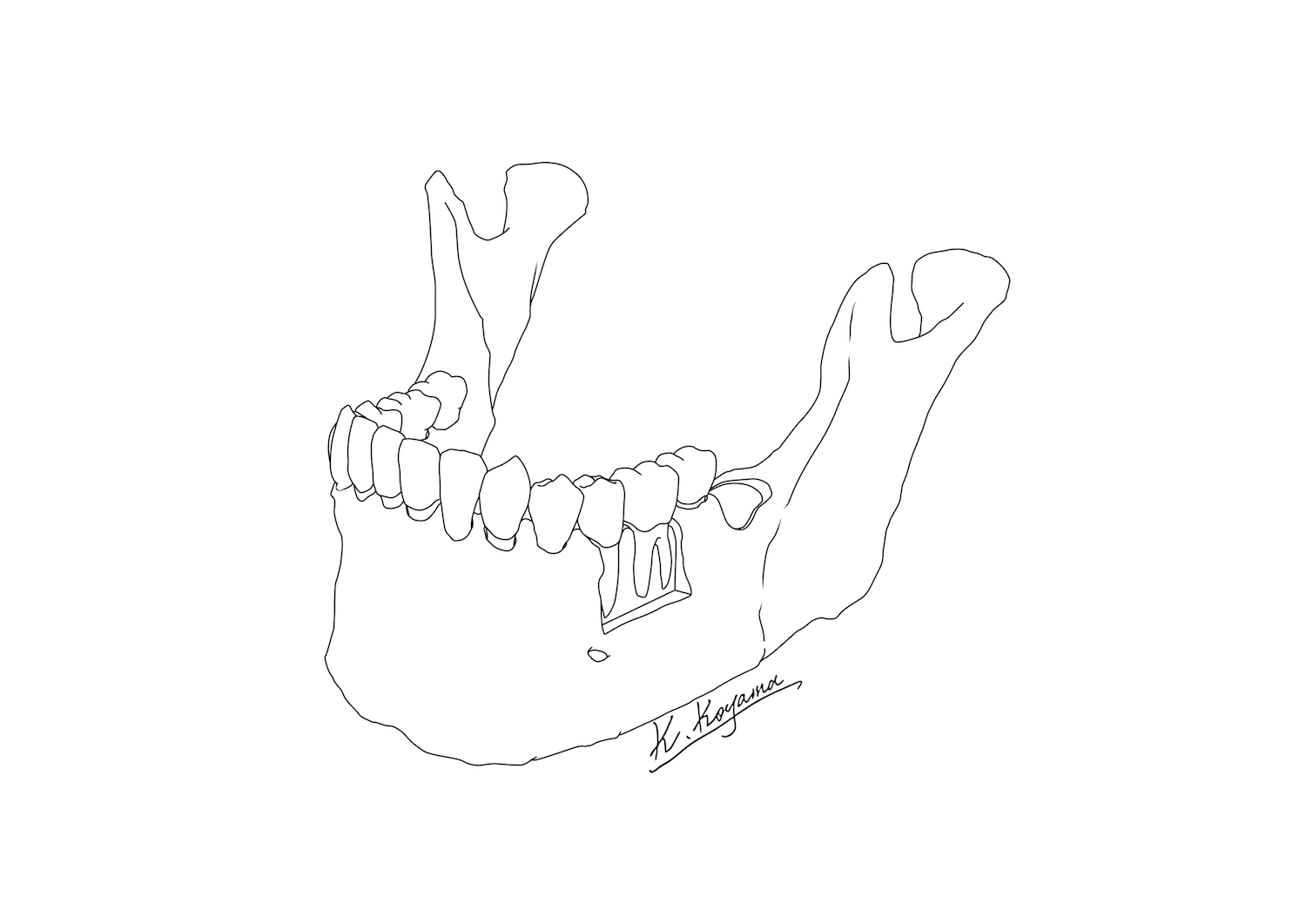 下顎骨イラスト・小山慶介