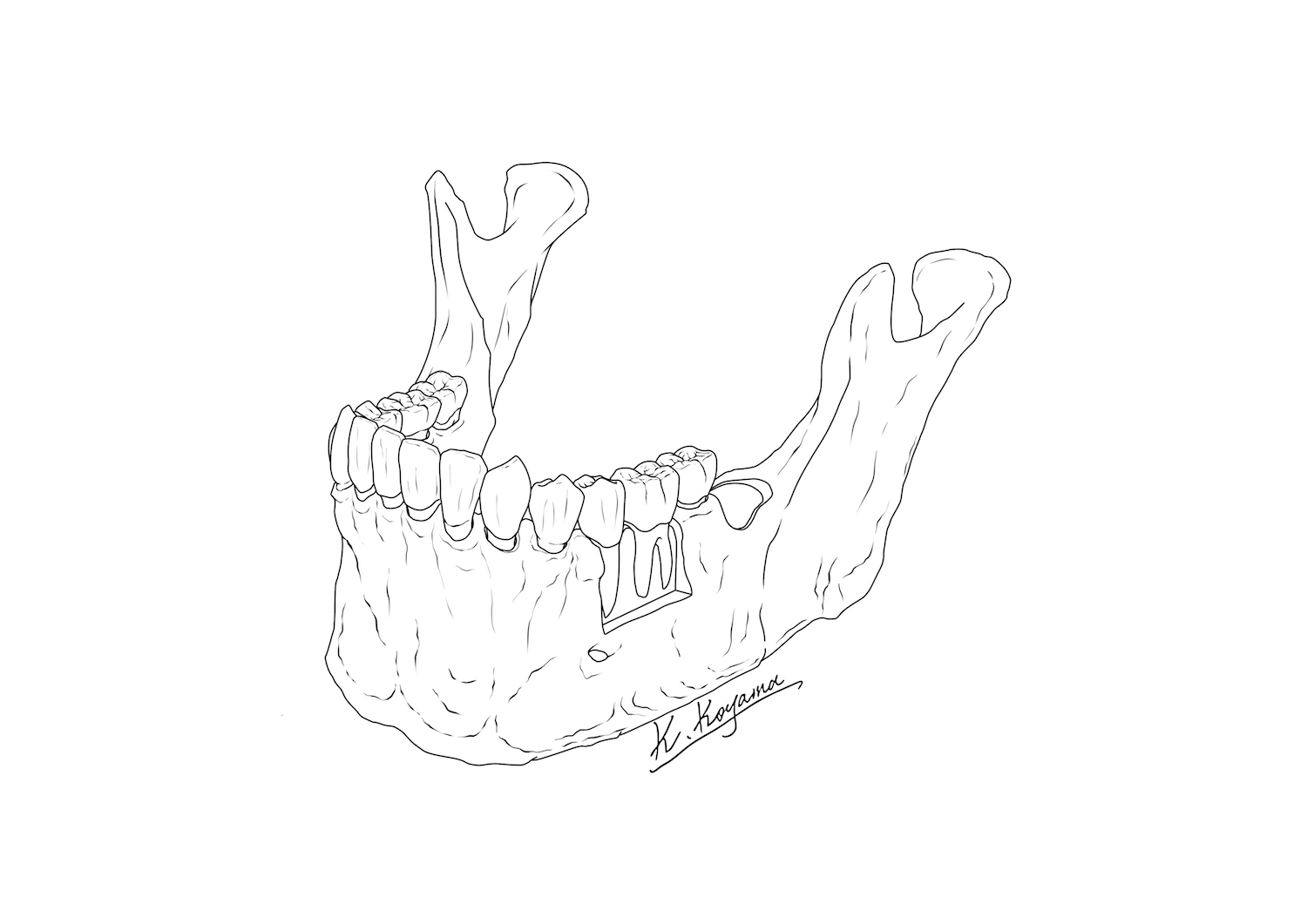 下顎骨イラスト・小山慶介