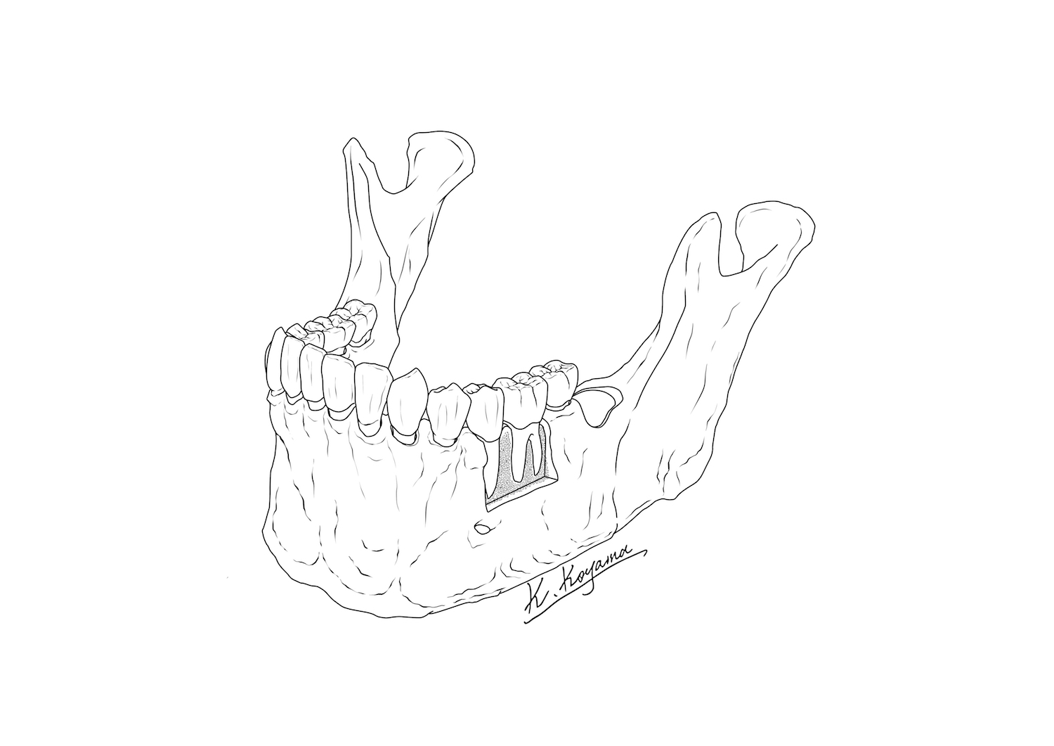 下顎骨イラスト・小山慶介