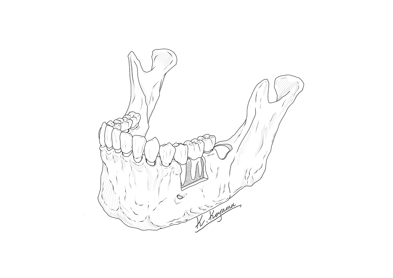下顎骨イラスト・小山慶介