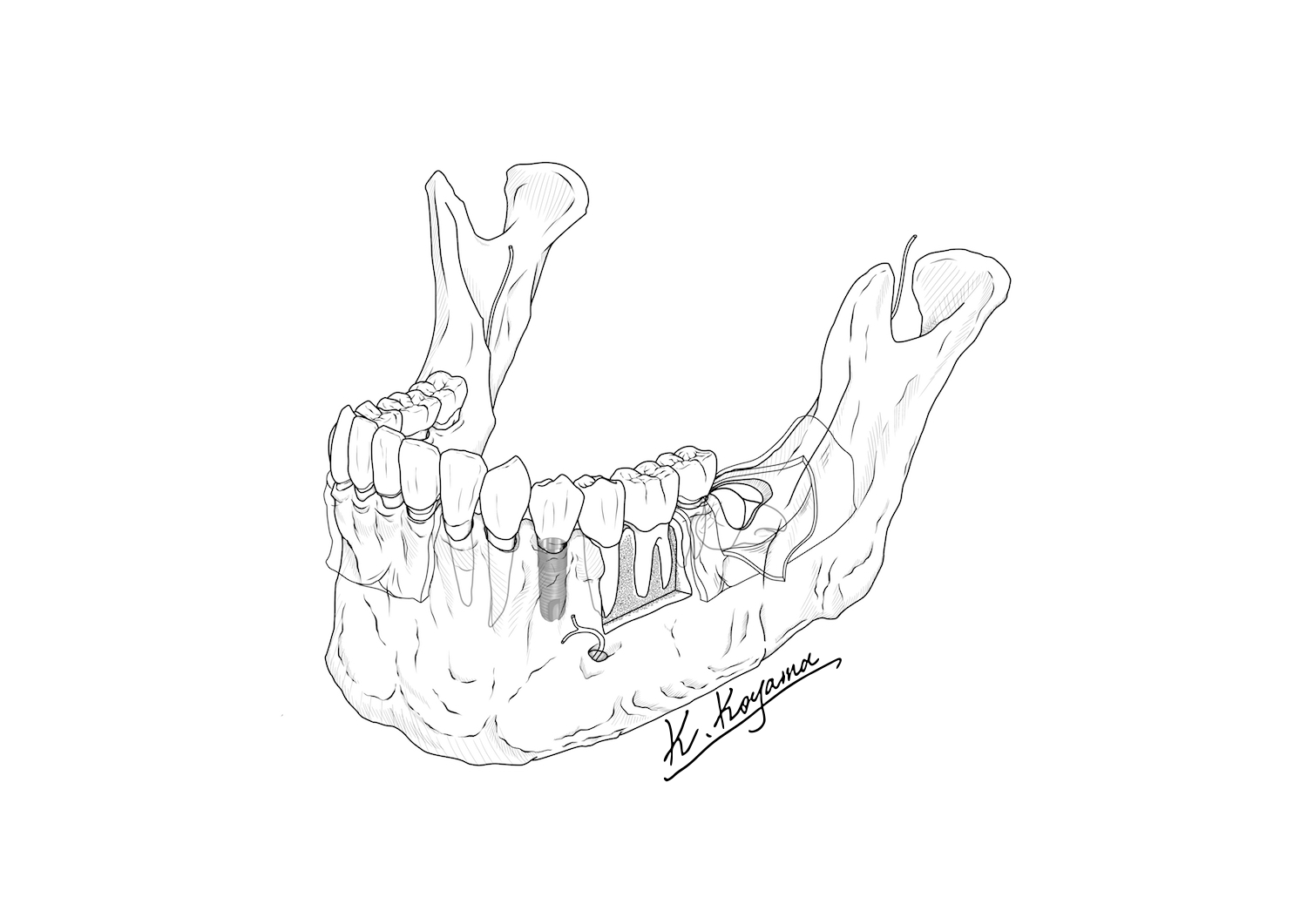 下顎骨イラスト・小山慶介