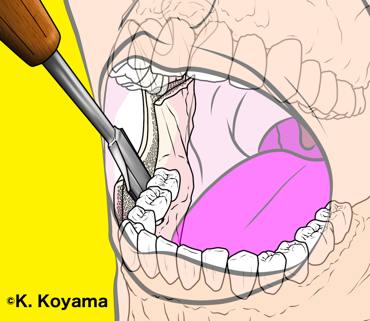 小山慶介　絵を描く口腔外科医　イラスト