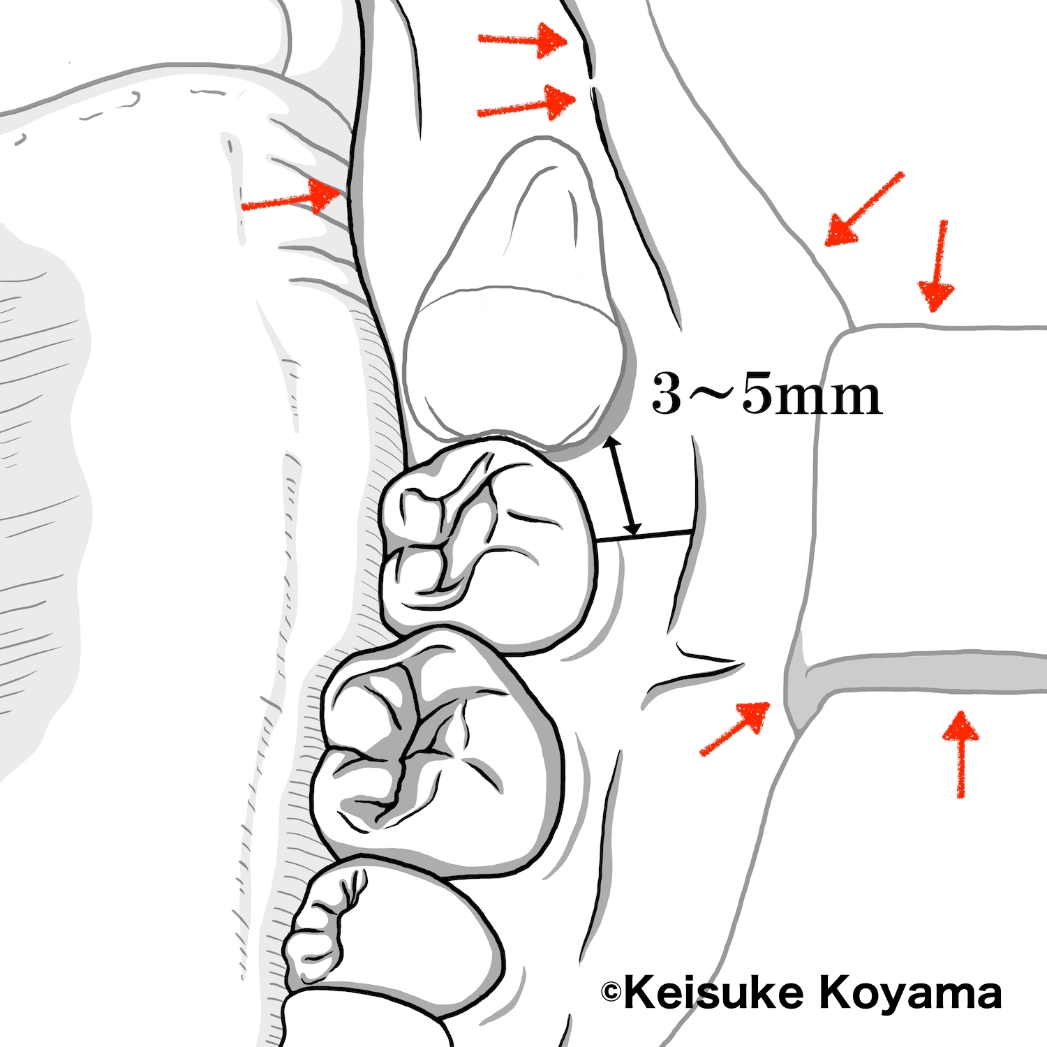 智歯イラスト　小山慶介