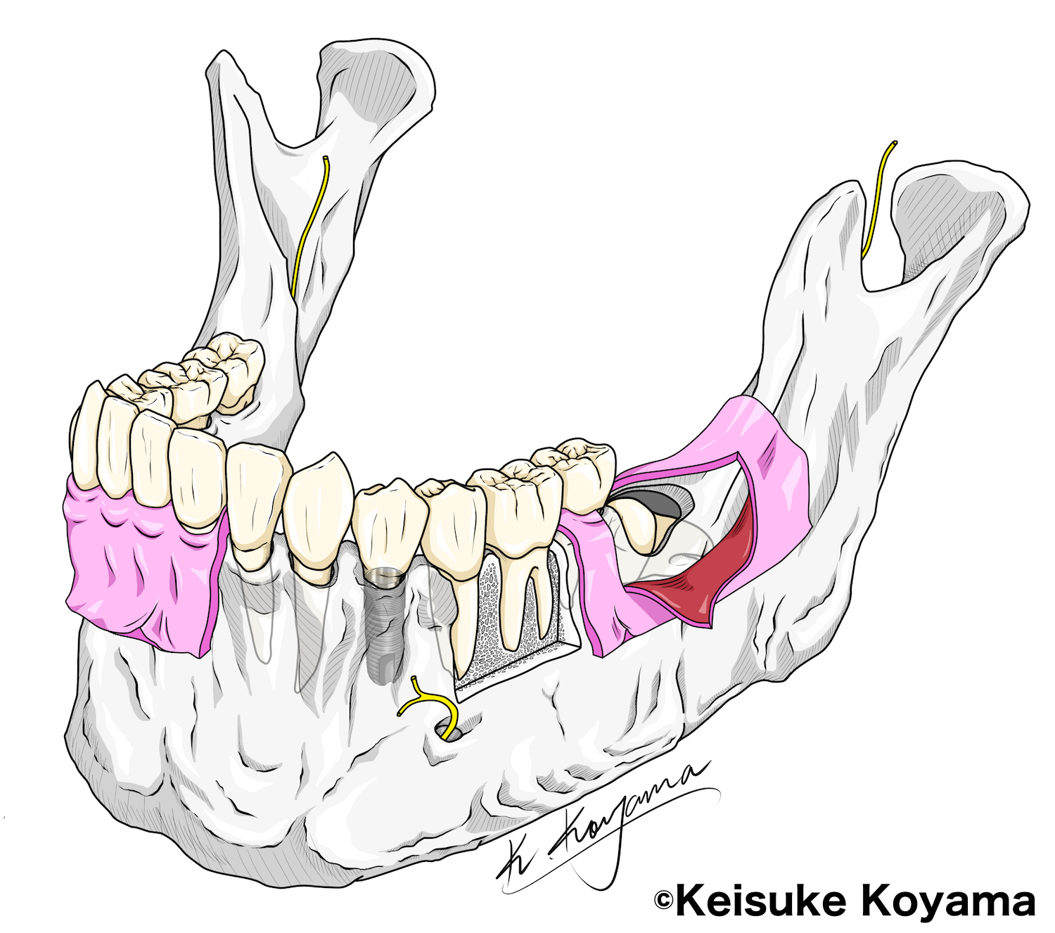 下顎骨イラスト　小山慶介