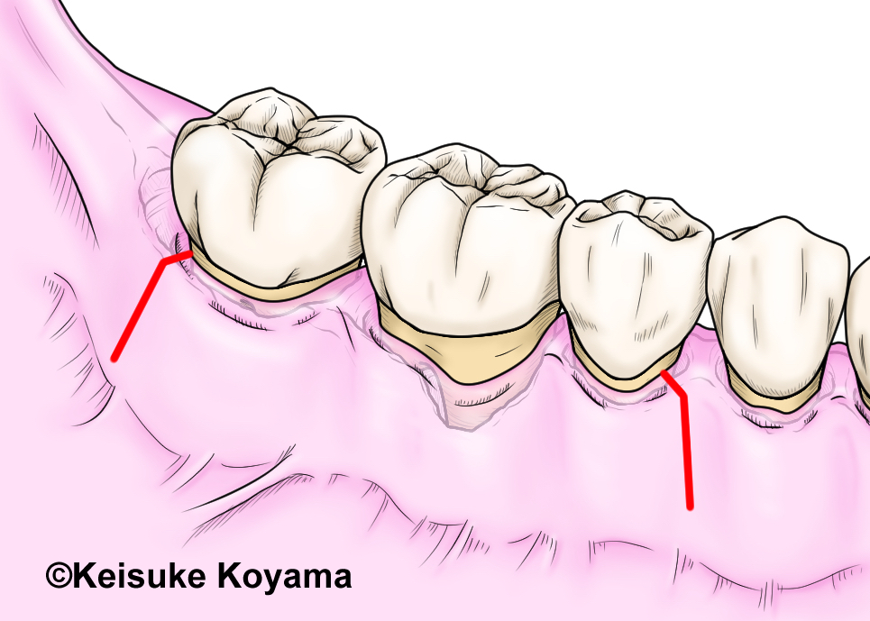 小山慶介　keisuke koyama