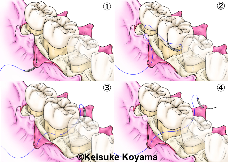 小山慶介　keisuke koyama