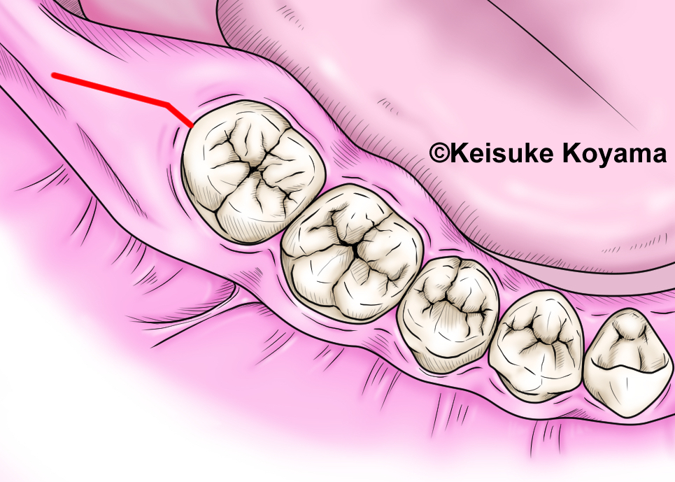 小山慶介　keisuke koyama