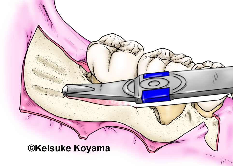 小山慶介　keisuke koyama