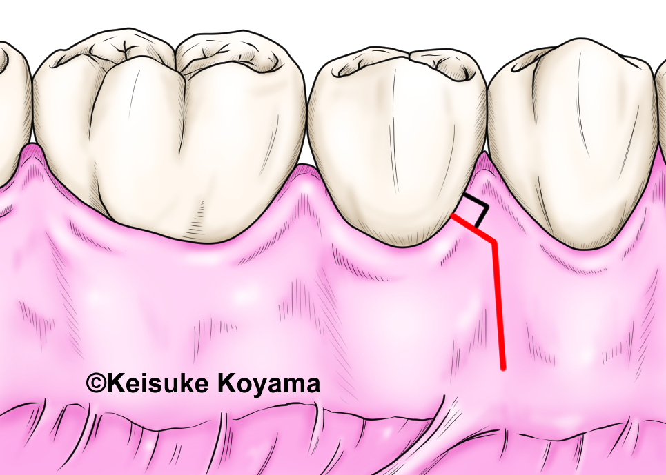 小山慶介　keisuke koyama